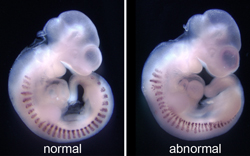 Figure 2. Even spacing of the muscle precursors is altered in embryos when somite patterning is disrupted (right).